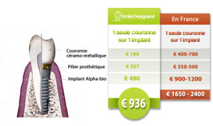 exemple de devis implant